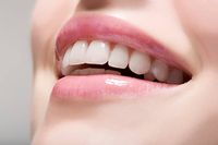 Invisalign - 85971 разновидности