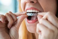 Invisalign - 48007 възможности