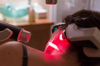 диодна лазерна епилация - 15494 възможности