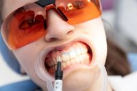 зъбни импланти - 57637 снимки