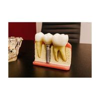 коронки - 38477 комбинации