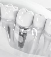 плазмолифтинг - 88973 отстъпки