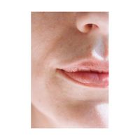 почистване на зъбен камък Варна - 12257 отстъпки