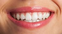 изтрити зъби - 14363 разновидности | Supreme Dental изтрити зъби - 79155 разновидности