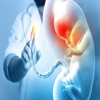 Стволови клетки от пъпна връв - 19463 промоции