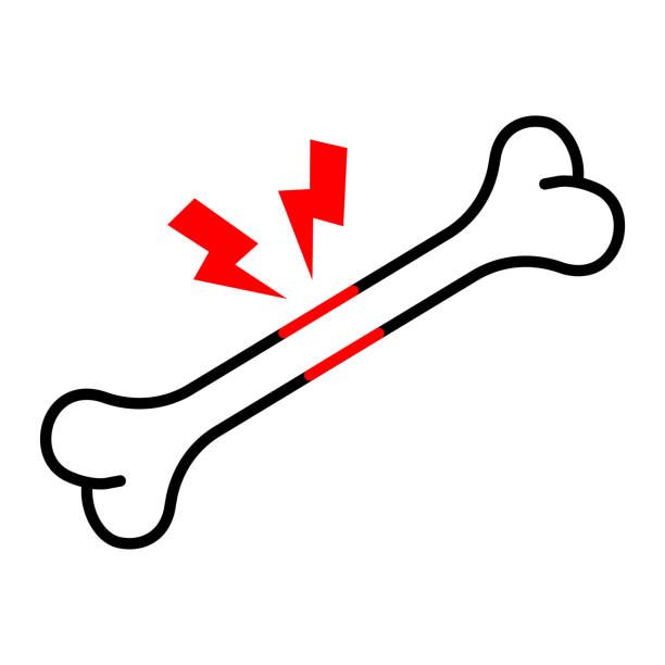 костна плътност - 12149 новини